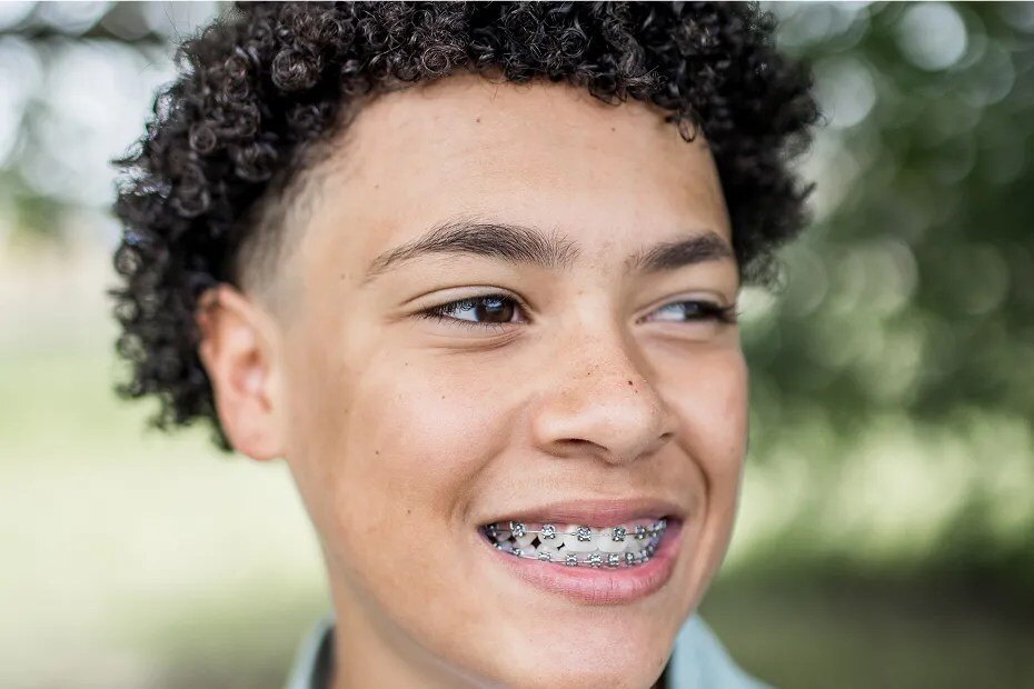 Patient smiling with Empower metal braces.
